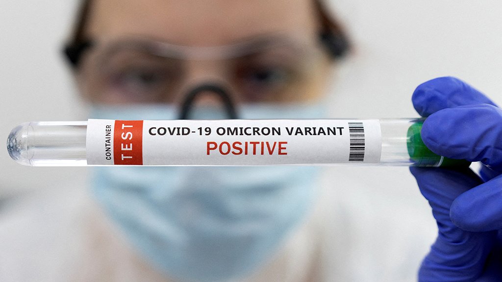 Первый в мире изотермический тест на COVID-19 зарегистрировали в России